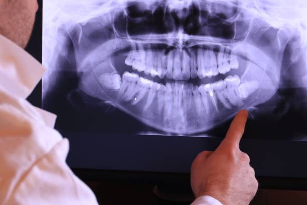 Best Emergency Denture Repair in Carrollton, MO