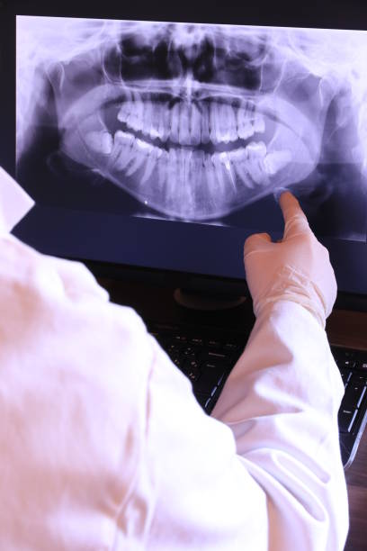 Best Broken or Chipped Tooth Repair in Carrollton, MO